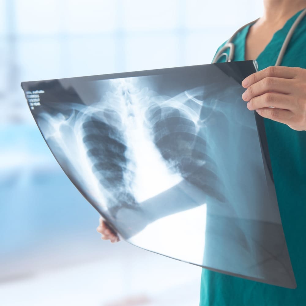 X-Ray Imaging